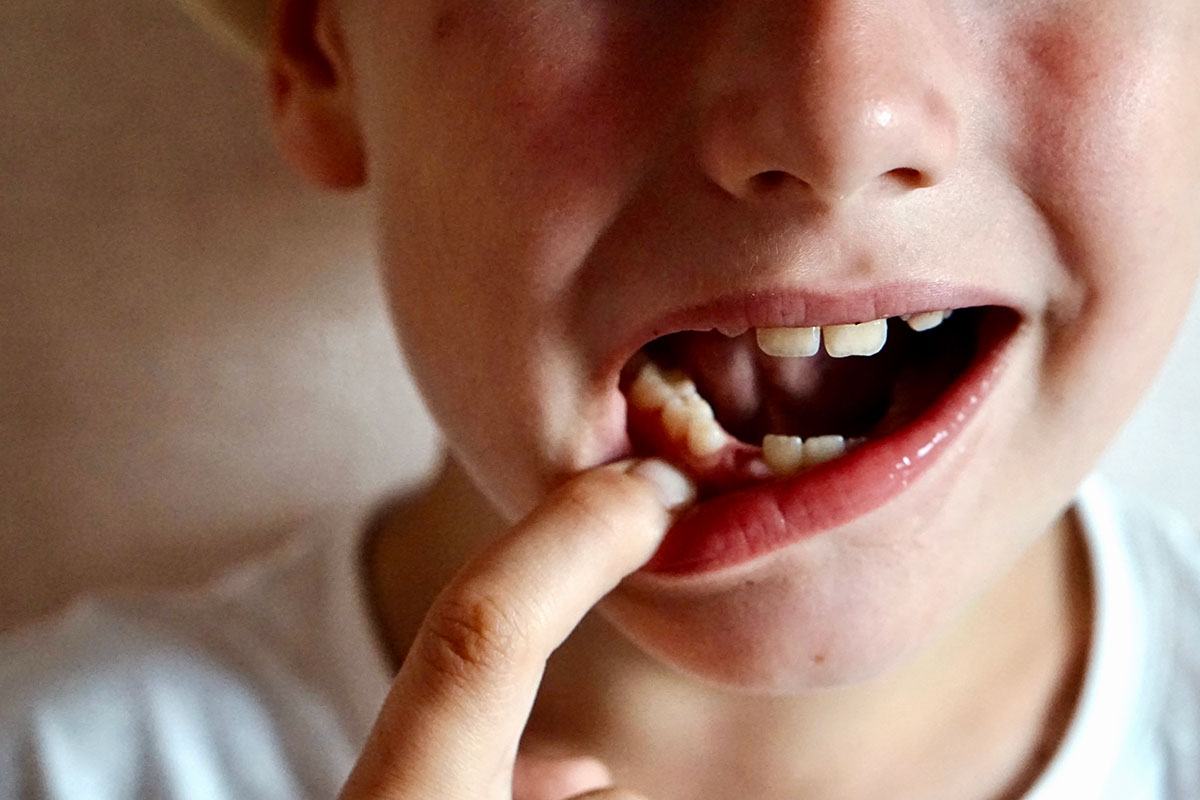 Çocuk Diş Hekimliği, Pedodonti Nedir?